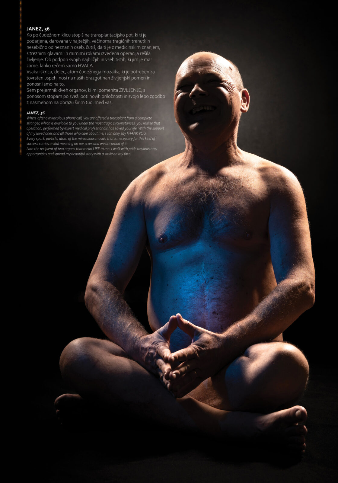 "My scar, my life" traveling exhibition: artistic nude photos and statements of organ recipients 