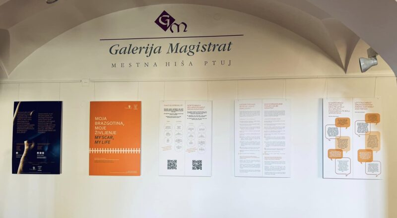 Razstava Moja brazgotina, moje življenje v galeriji Magsitrat